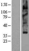 SLC18A2 / VMAT2 Protein (Over-Expression Lysate Myc-DDK (Flag))