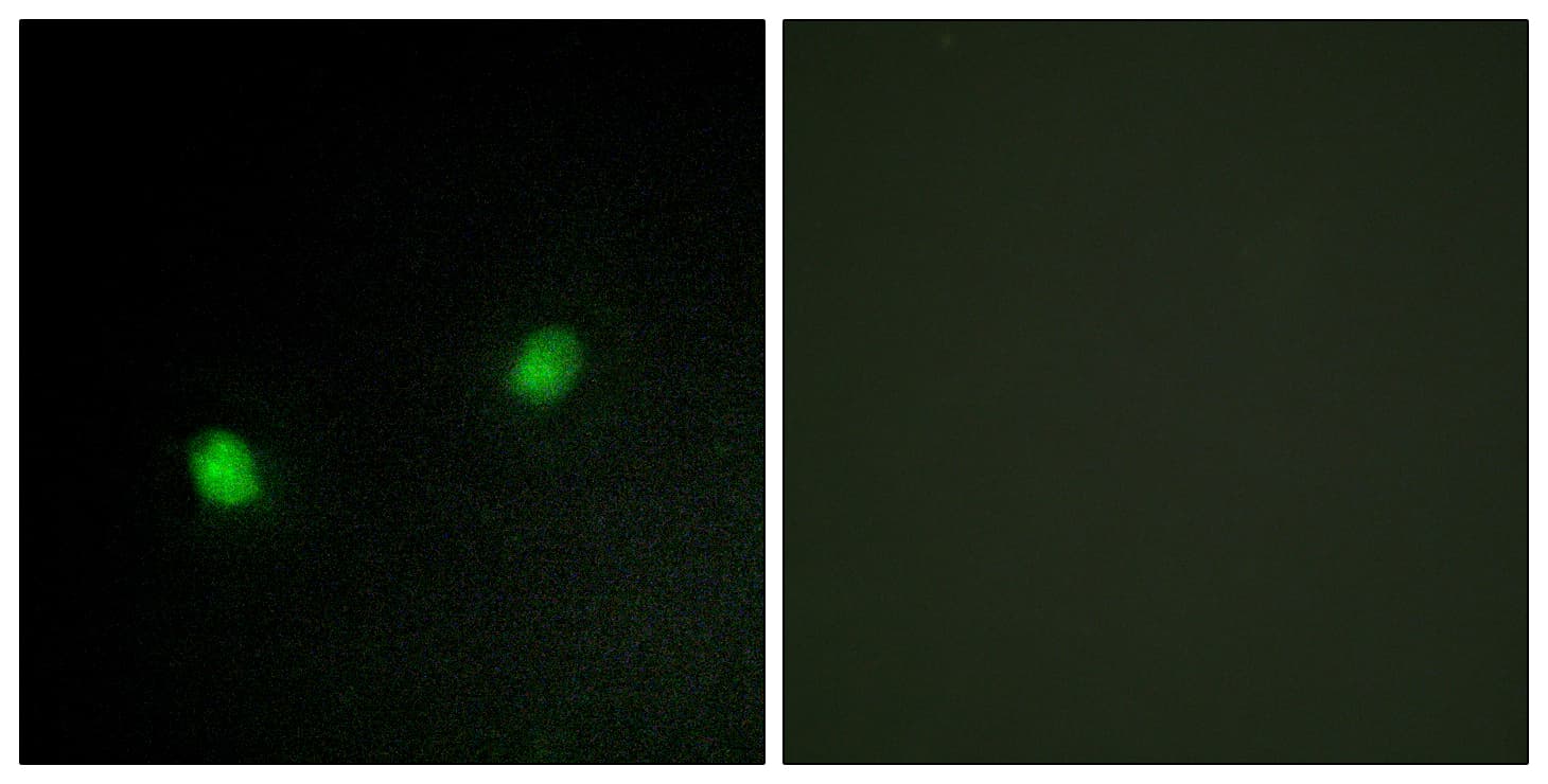 Polyclonal Rabbit anti-Human ZNF7 Antibody (aa41-90, IHC, IF)