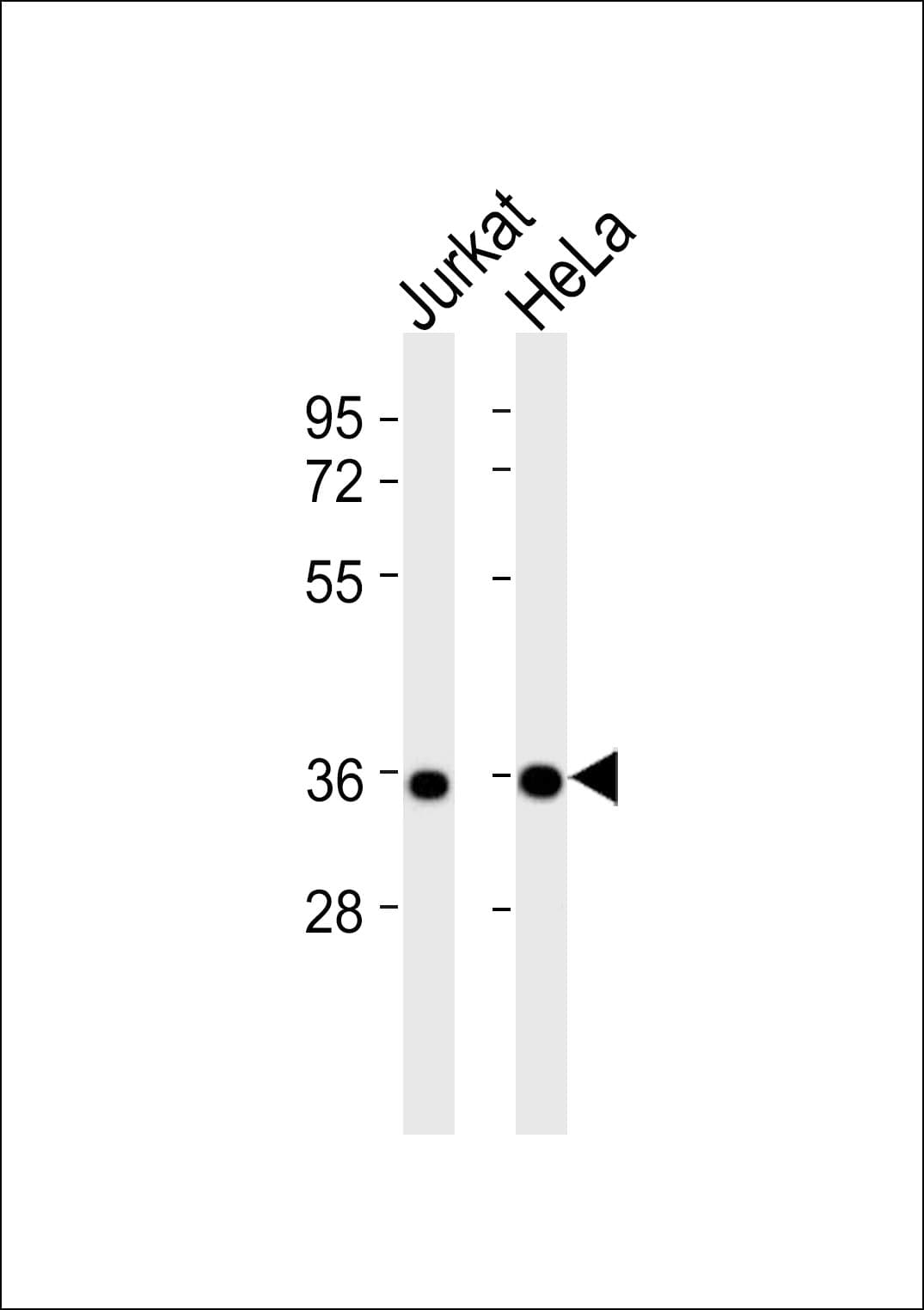 CASP2 / Caspase 2 Antibody