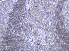 c-Kit / CD117 Antibody (clone OTI2E3)