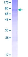 Human ZNF354C Protein (Recombinant GST)