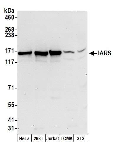IRS Antibody (aa1212-1262)