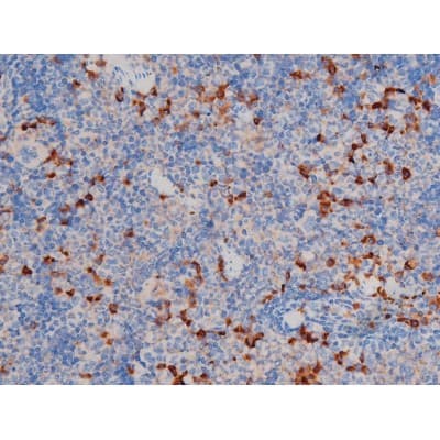 AKT1 Antibody (phospho-Ser124)