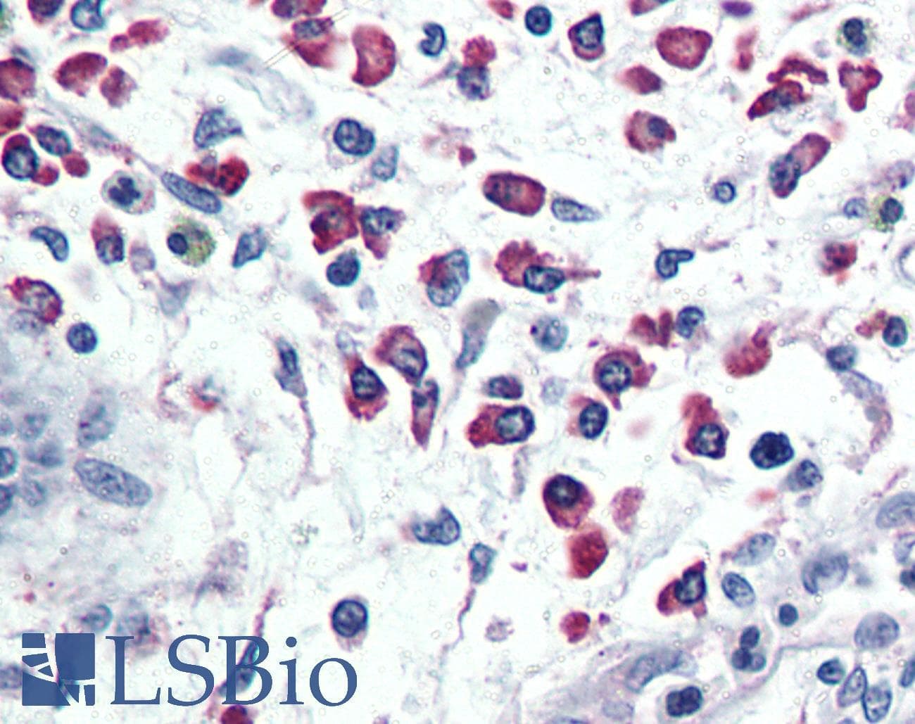 IHC-plus™ Polyclonal Rabbit anti-Human CXCR1 Antibody (Internal, IHC)