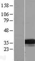 TMEM74 Protein (Over-Expression Lysate Myc-DDK (Flag))