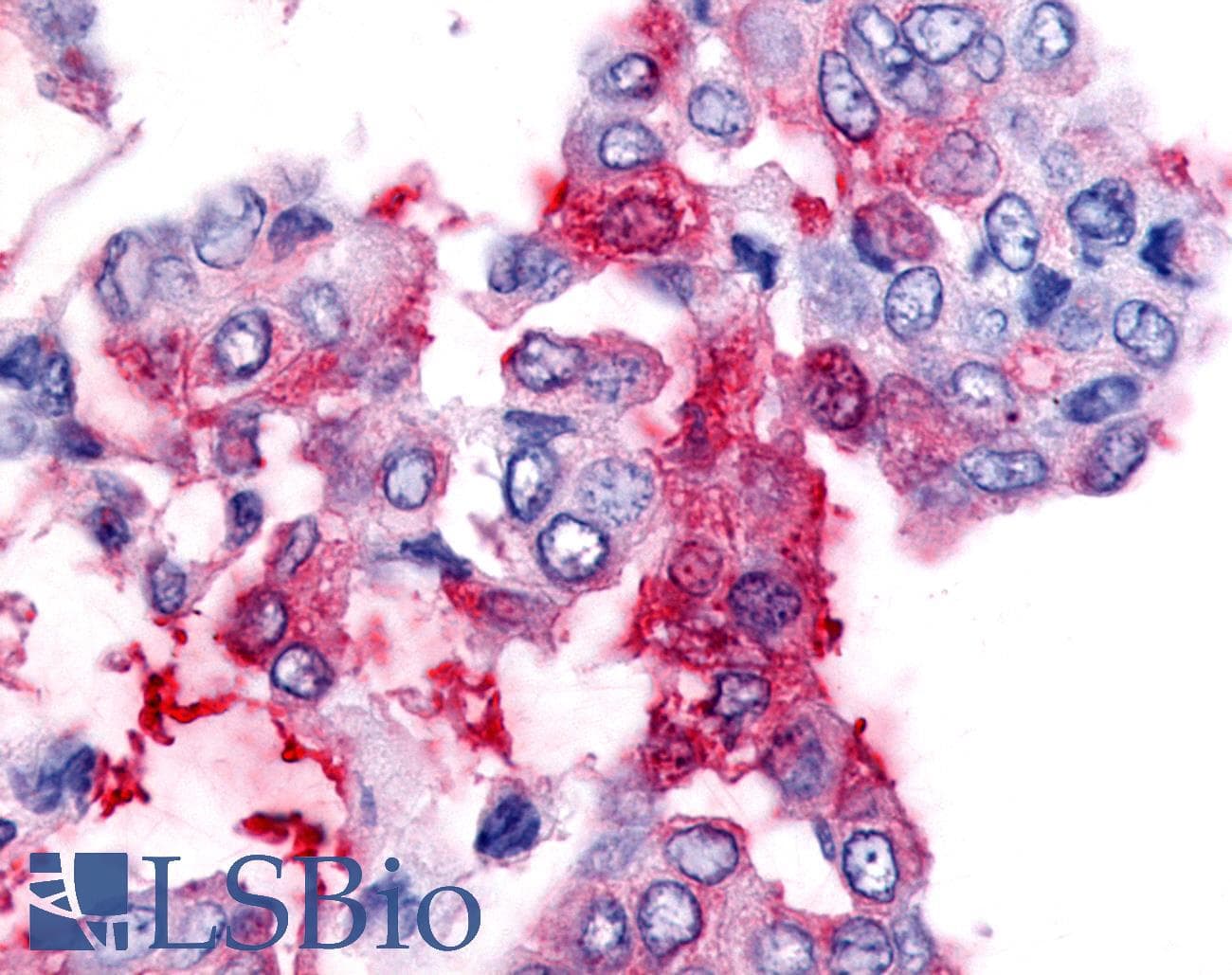 PathPlus™ NR5A2 / LRH-1 Antibody (Internal)