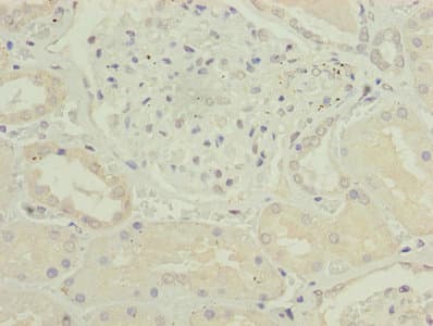 CKS2 Antibody