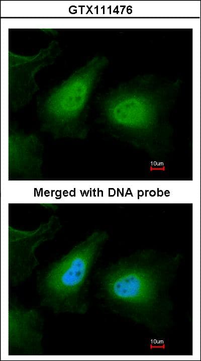 ULK2 Antibody (aa693-968)