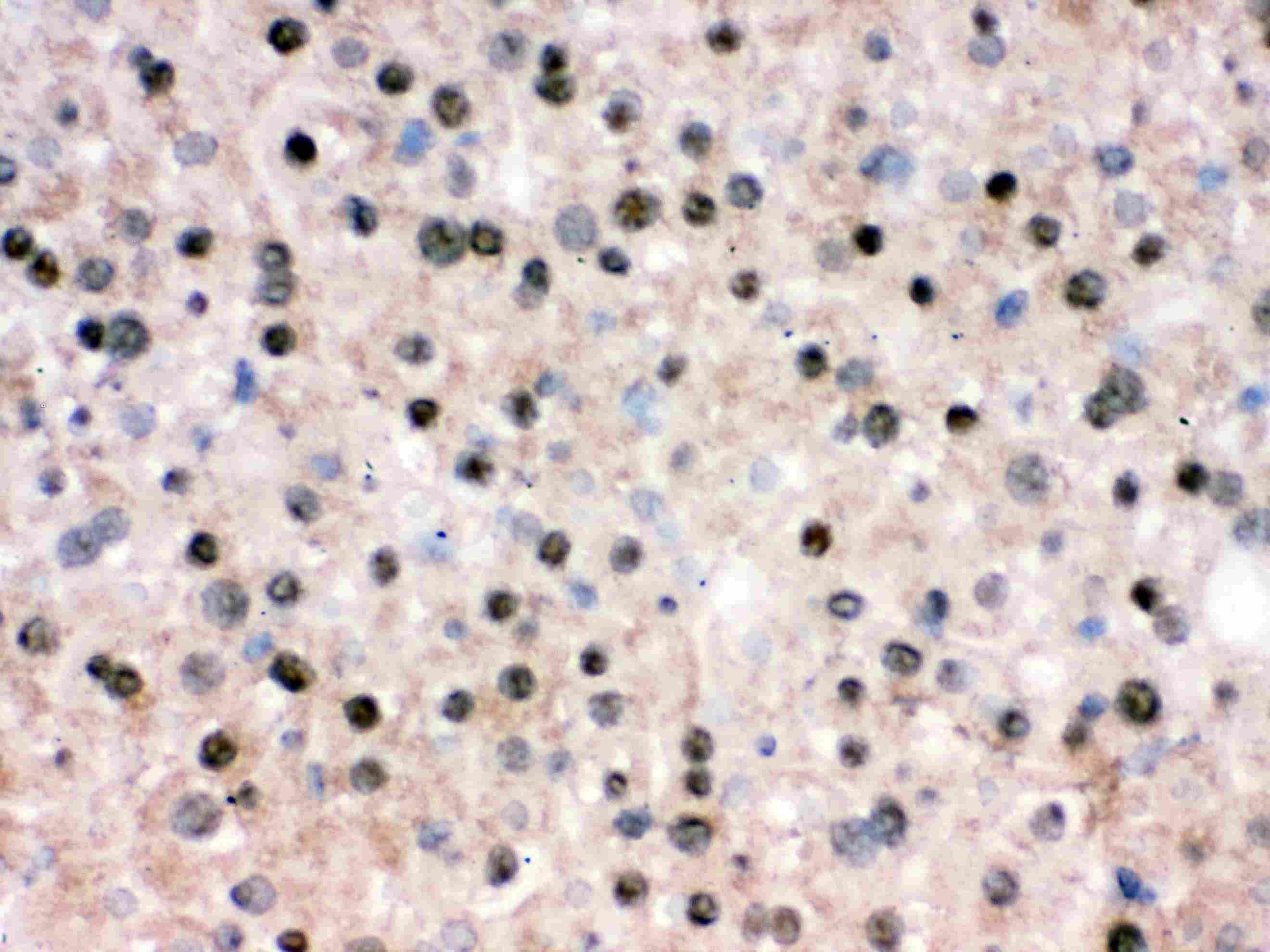 RBBP4 / RBAP48 Antibody (aa395-425)