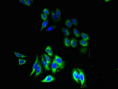 P2Y13 / P2RY13 Antibody
