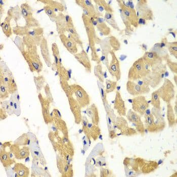 HMT / HNMT Antibody