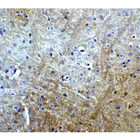 SLITRK1 Antibody
