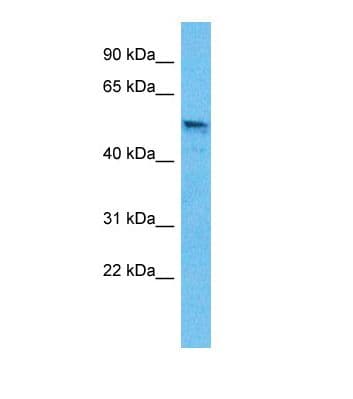 GABRB3 Antibody (aa188-237, Biotin)