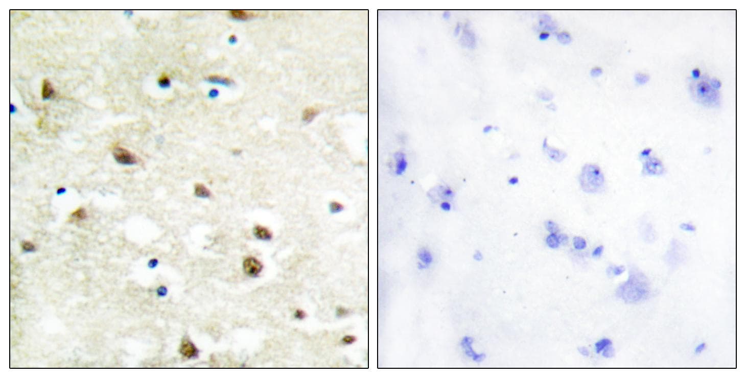 Polyclonal Rabbit anti-Human HNRNPC / HNRNP C Antibody (IHC, IF, WB)