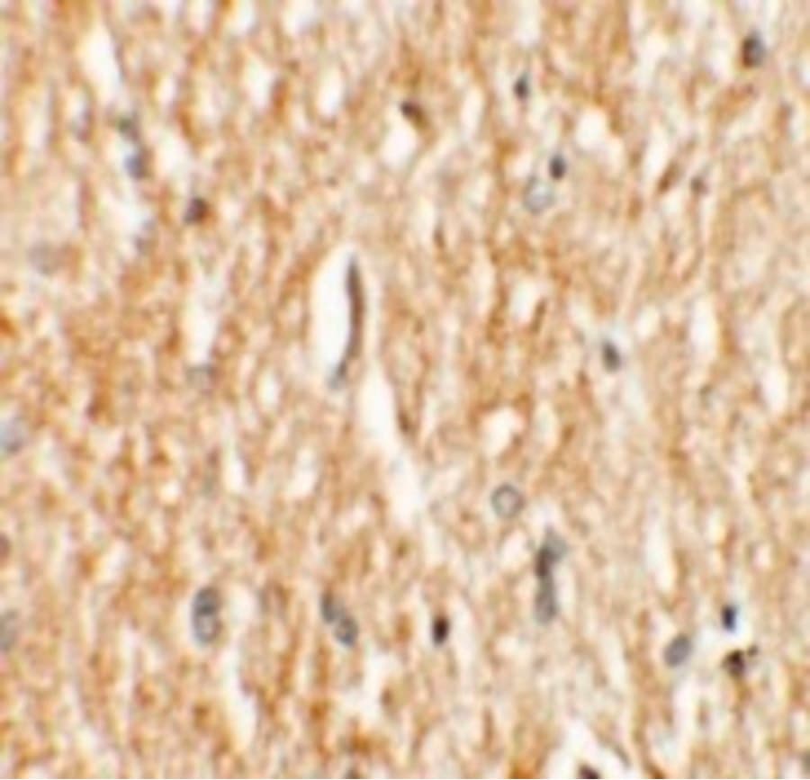 PHOX2A Antibody
