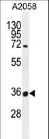 Polyclonal Rabbit anti-Human OR7G1 Antibody (aa1-30, WB)