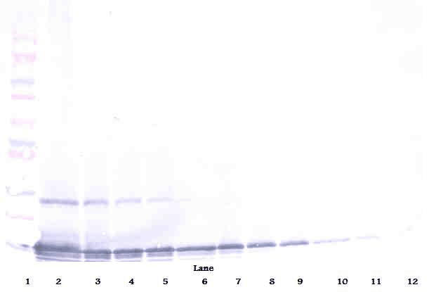 Polyclonal Rabbit anti-Human CCL25 / TECK Antibody (Biotin, WB)