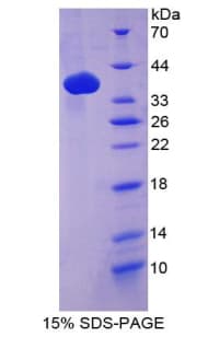 Mouse Lgals6 / Galectin-6 Protein (Recombinant His-T7)