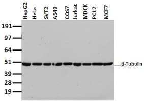 Monoclonal Mouse anti-Human TUBB4 / Tubulin Beta 4 Antibody (clone OTI5C1, IHC, IF, WB)
