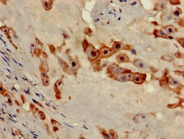 NOB1 / NOB1P Antibody