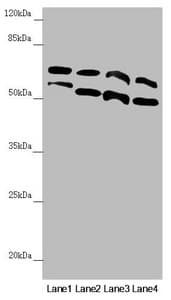 Polyclonal Rabbit anti-Human CDC45 Antibody (IHC, IF, WB)