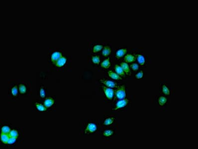IHC-plus™ KAT5 / TIP60 Antibody (aa3-512)