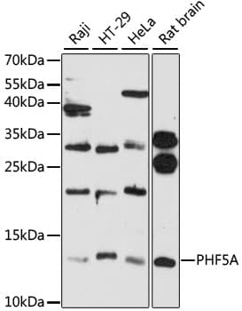 Polyclonal Rabbit anti-Human PHF5A / INI Antibody (WB)