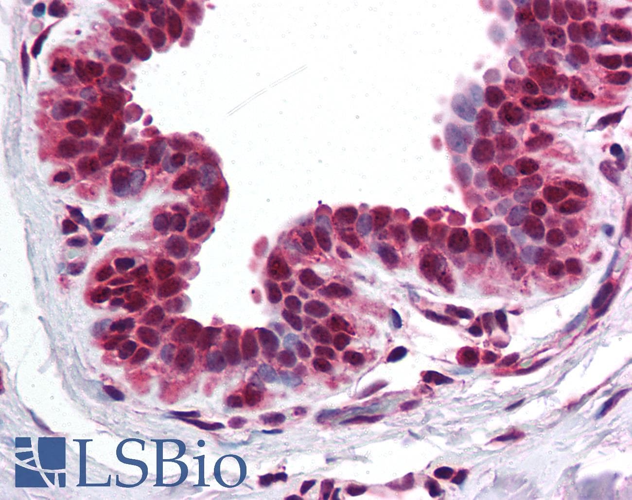 BRD2 / RING3 Antibody (aa524-573)