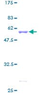 Human HLA-DPA1 Protein (Recombinant GST)
