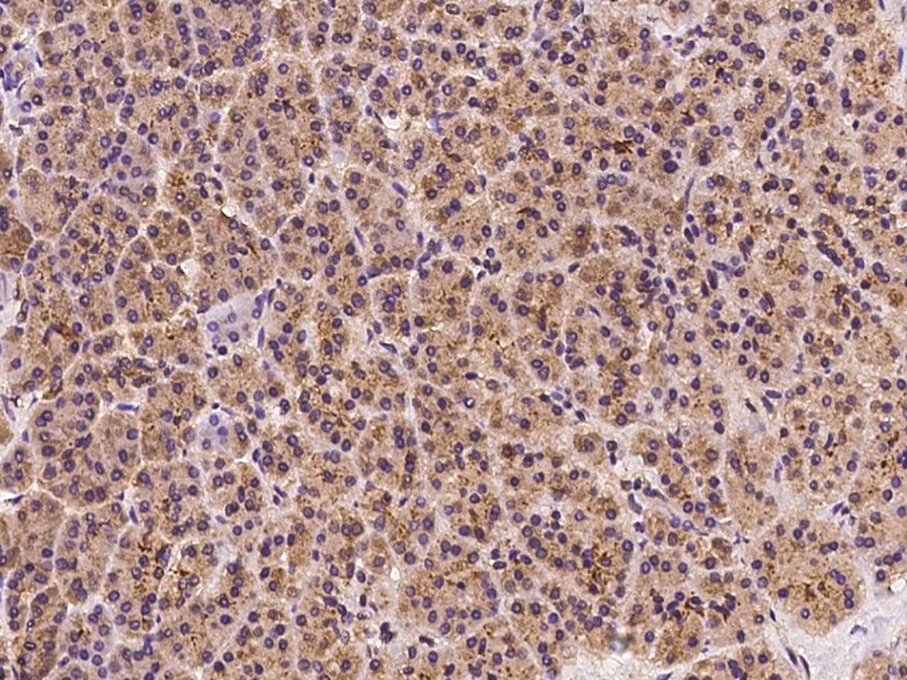 Polyclonal Rabbit anti-Human VAP33 / VAPA Antibody (IHC, IF)