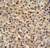 Polyclonal Rabbit anti-Human MISP / C19orf21 Antibody (aa63-91, IHC, WB)