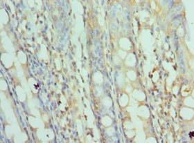 SRPK1 Antibody (aa290-480)