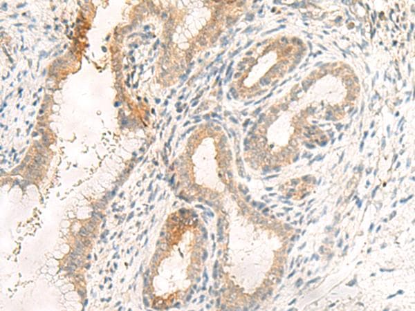 GPR89A Antibody