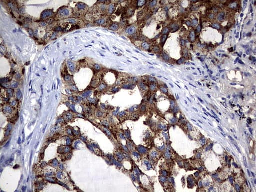 CEACAM5 / CD66e Antibody (aa35-680, clone OTI2B12)