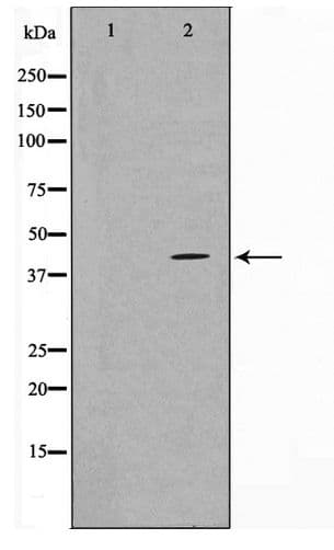 TBX10 Antibody