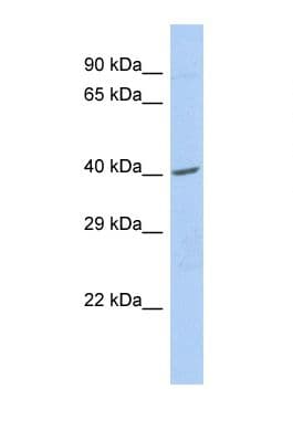 Polyclonal Rabbit anti-Human ZNF140 Antibody (aa180-229, WB)