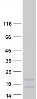 Human IGFL1 Protein (Recombinant Myc-DDK (Flag))