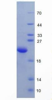 Human HFE2 / Hemojuvelin Protein (Recombinant His)