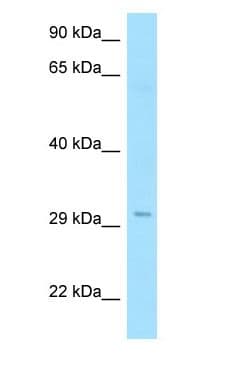 Polyclonal Rabbit anti-Human RTP1 Antibody (aa25-74, WB)