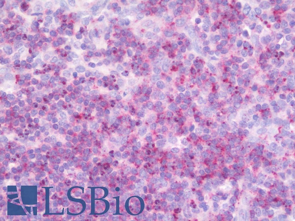 IHC-plus™ HOXB7 Antibody (aa93-121)