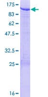 Human SKIL / SNO / SnoN Protein (Recombinant GST)