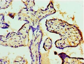 Polyclonal Rabbit anti-Human COIL / Coilin Antibody (aa297-576, IHC, WB)