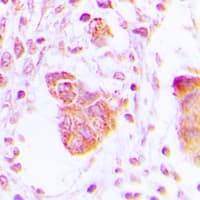 MOV10L1 Antibody (Internal)