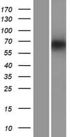 PDILT Protein (Over-Expression Lysate Myc-DDK (Flag))
