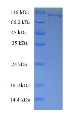 Human MTRR Protein (Recombinant GST)