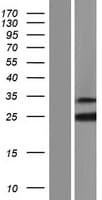 RBM18 Protein (Over-Expression Lysate Myc-DDK (Flag))