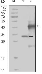 EPHA4 / EPH Receptor A4 Antibody (clone 7D3D4)