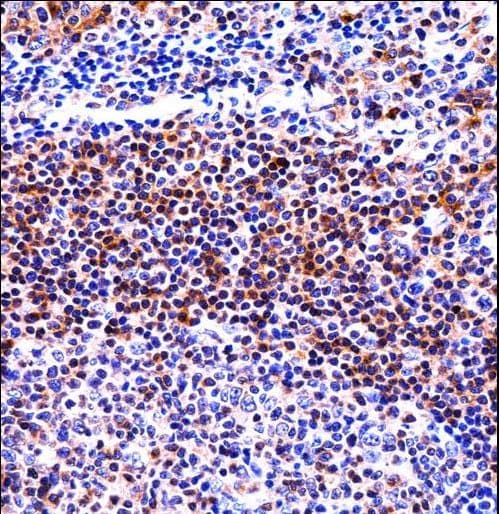 IL32 Antibody (aa24-53)