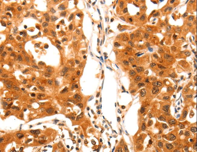 SERPINB5 / Maspin Antibody