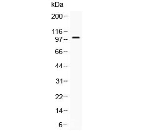 NARG1 / NAA15 Antibody